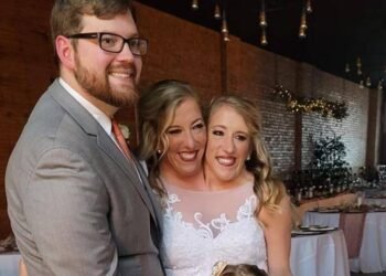 زواج أشهر توأم ملتصق في العالم