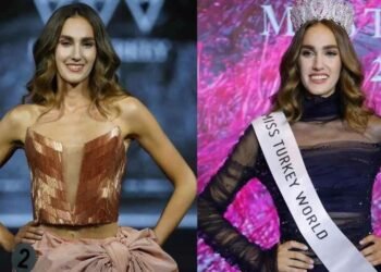 ملكة جمال تركيا تتعرض للتنمر بسبب شكلها