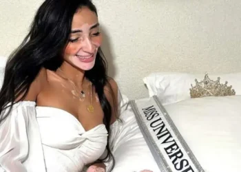 لوجينا صلاح تتربع على عرش الجمال رغم معاناتها من مرض البهاق!