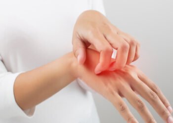 الأكزيما والصدفية.. دليل شامل لتمييز الأعراض