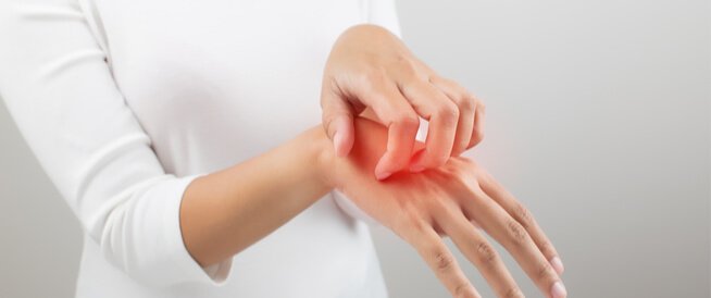 الأكزيما والصدفية.. دليل شامل لتمييز الأعراض