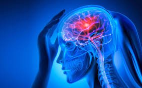 ما هو اليوم العالمي للسكتة الدماغية؟