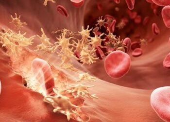 ما هو مرض الهيموفيليا؟