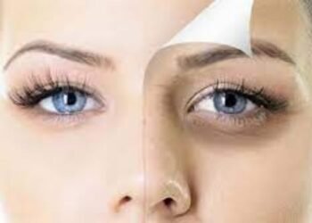 طرق عملية ومنتجات فعّالة للتخلص من الهالات السوداء في رمضان