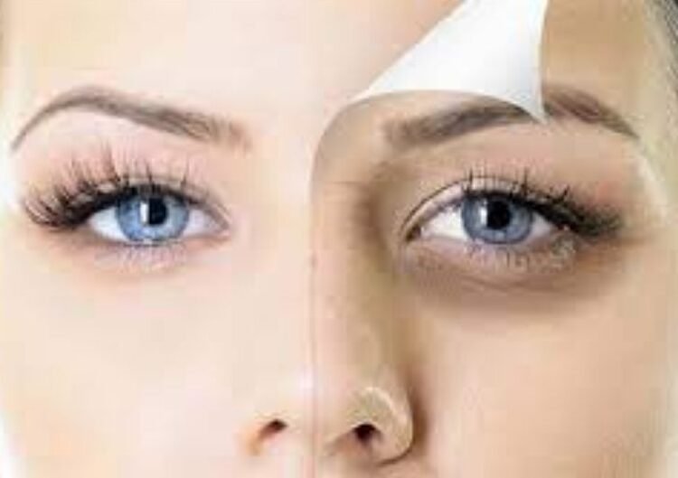 طرق عملية ومنتجات فعّالة للتخلص من الهالات السوداء في رمضان