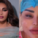 أحلام الشامسي تكشف عن إجراء تجميلي لشد الوجه
